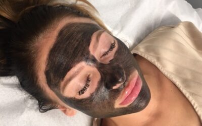 The “Famous Carbon Facial” – Worth the Hype?